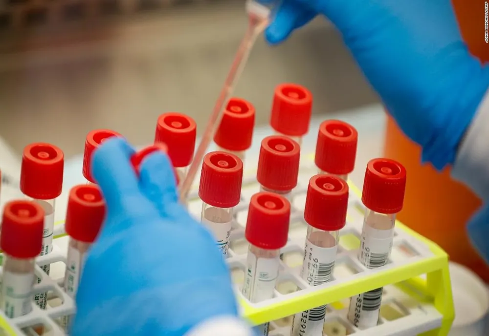 Un nou deces cauzat de infecția cu coronavirus, a fost raportat în Bacău