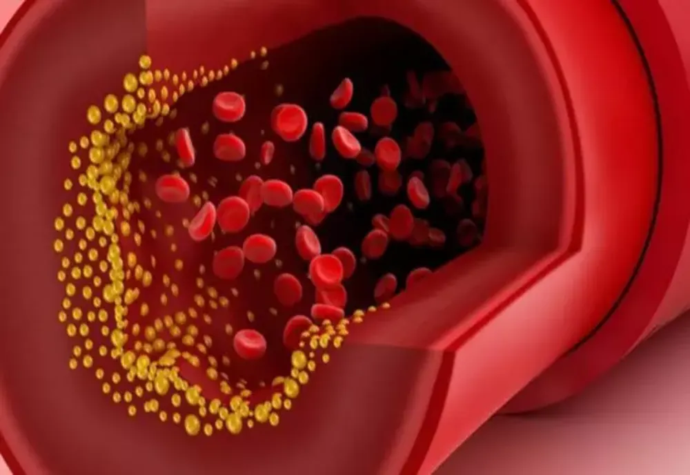 Alimentele care curăță vasele de sânge de colesterol și reduc riscul de infarct