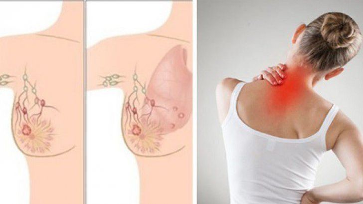 109 cazuri noi de cancer de sân înregistrate în județul Bacău în prima jumătate a anului. Campanie de prevenire inițiată de DSP Bacău