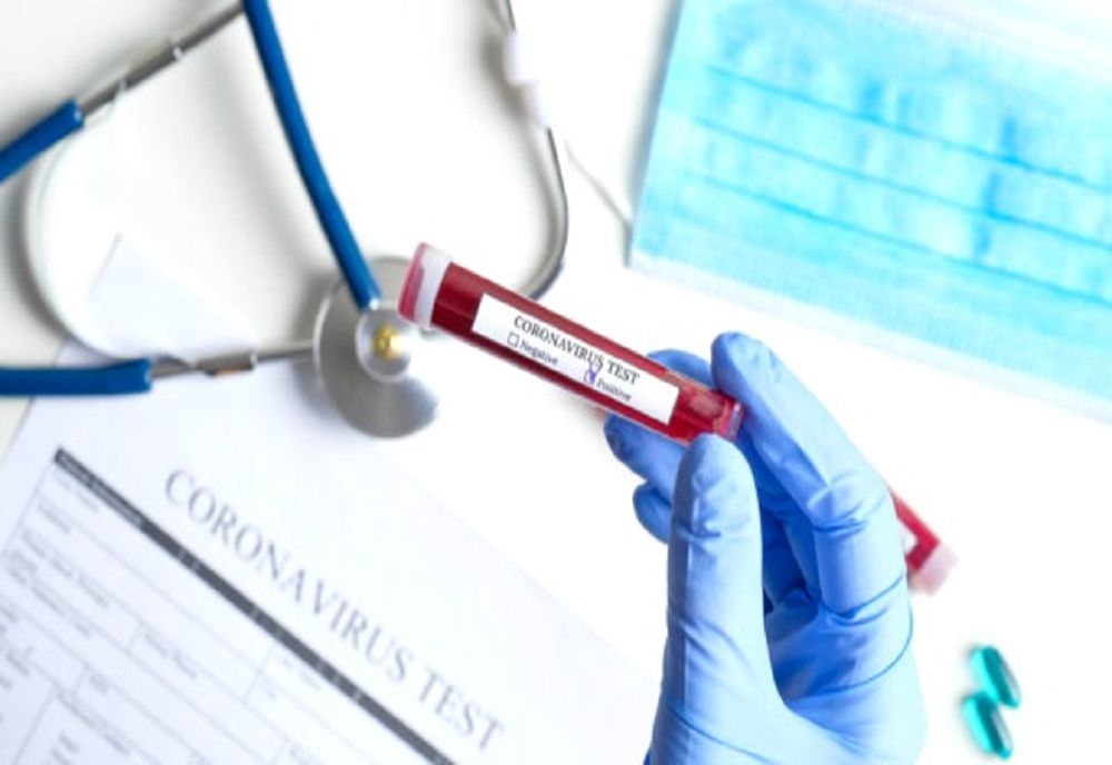 Laboratorul  de analize medicale din Hemeiuş poate procesa 1.000 de probe pe zi pentru COVID-19 