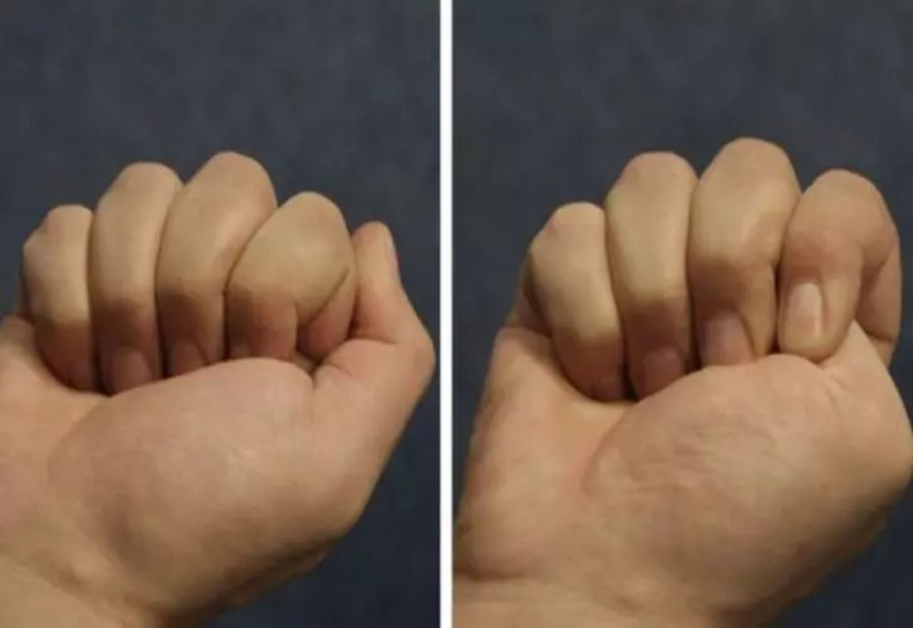 Testul care îţi spune cele mai ascunse lucruri despre tine. Tu cum strângi pumnul?