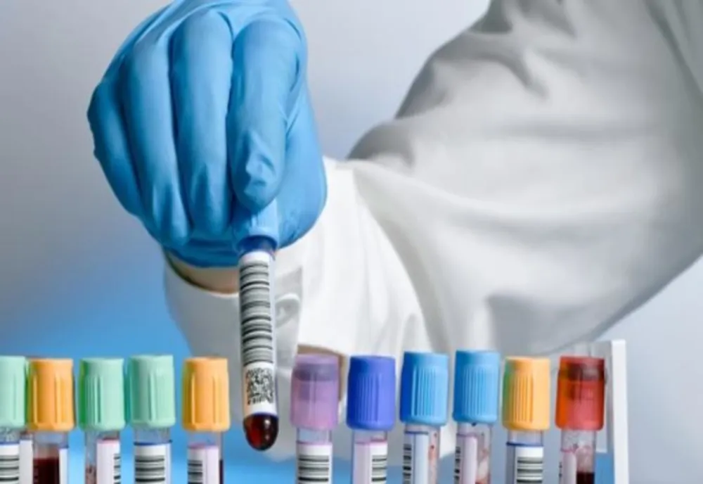 ANALIZELE PERIODICE POT FACE DIFERENȚA ÎNTRE UN DIAGNOSTIC PRECOCE ȘI O BOALĂ DESCOPERITĂ PREA TÂRZIU