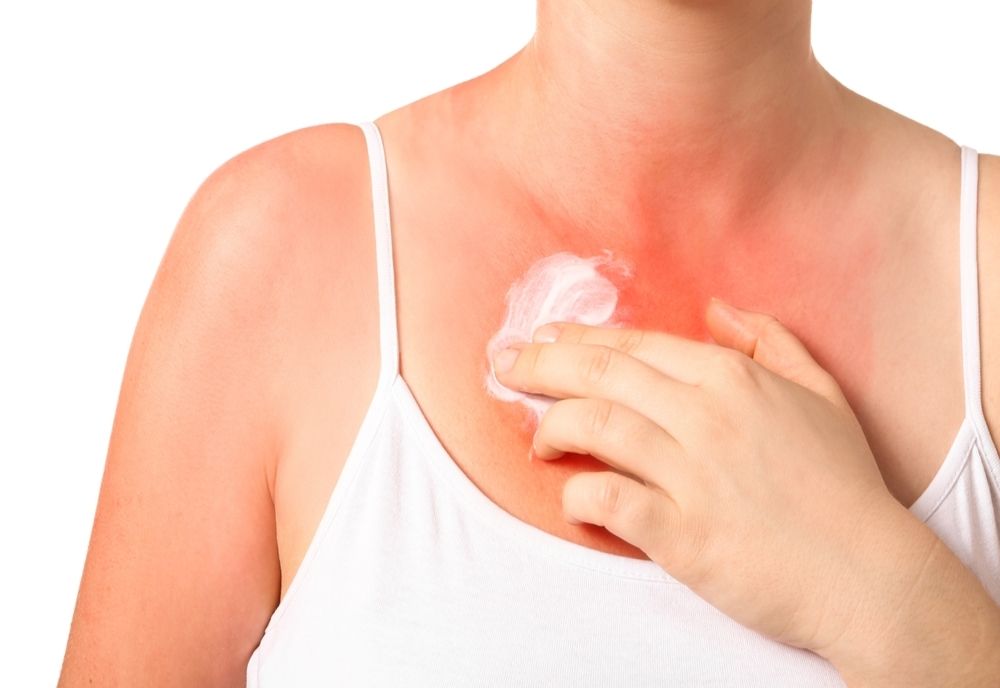 Ce sunt alergiile solare și care sunt simptomele