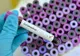 Copil de 1 an din Bacău confirmat cu coronavirus