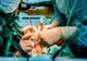 Șapte intervenţii de transplanturi de rinichi, în ultimele şase zile la Spitalul "Dr.C.I.Parhon". Primitorii sunt din judeţele Vaslui, Bacău, Suceava, Iaşi și Vrancea